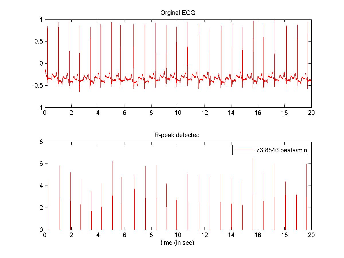 Wavelet